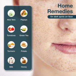 home remedies for dark spots on face