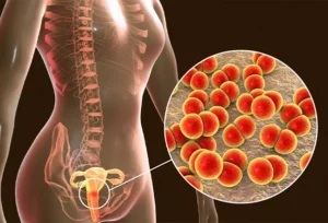 What Are STDs and How Do They Affect Women