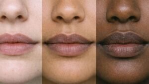 lip-discoloration-comparison-skin-tones-