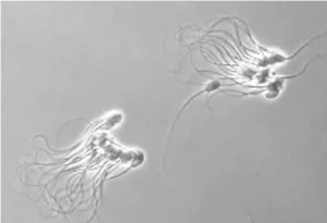 What Is Sperm Agglutination?