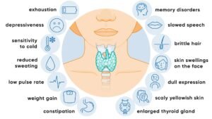 Symptoms of Hypothyroidism (Underactive Thyroid)