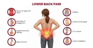What Causes Back Pain