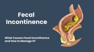 What Is Bowel Leakage (Fecal Incontinence)