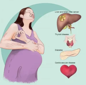 What Is Itching During Pregnancy