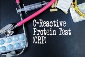 What is a C-reactive protein test